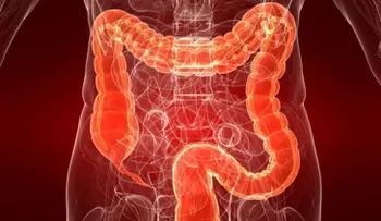 Colitis ulcerosa: una enfermedad desconocida