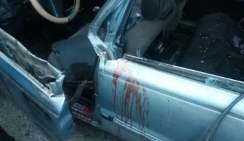 Camión desprende brazo izquierdo de chofer de carro público al rebasarle