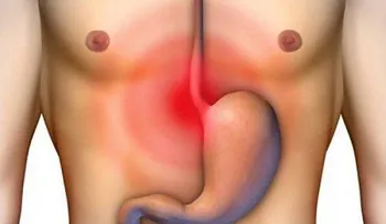 En 7 días y para siempre elimina la acidez y gastritis 