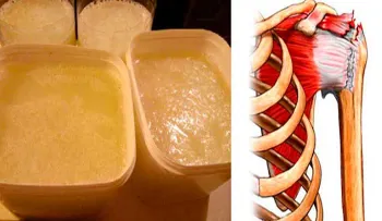 Elixir especial para rehabilitar con éxito los tendones y ligamentos de las rodillas