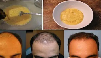 Mezcló banana (guineo) y cerveza y lo aplicó al pelo durante 7 días. Resultados imperdibles. 