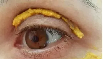 Si tienes ojeras, esta es la solución pefecta. Funciona en mujeres y hombres