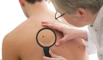 5 razones sorpresivas para visitar al dermatólogo