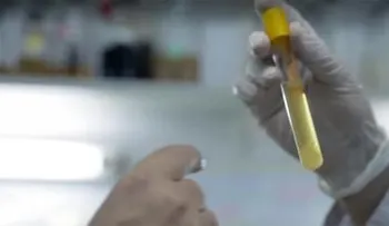 Científicos descubren que una bacteria aumenta la longevidad