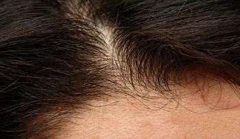 Cómo fortalecer el cuero cabelludo de forma natural