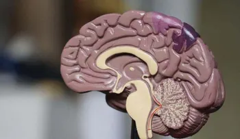 Pacientes pueden sufrir daños en el cerebro por COVID-19