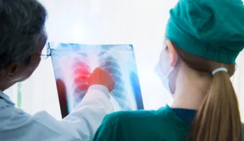Especialista destaca la detección temprana del cáncer de pulmón tras el caso del papa León XIV