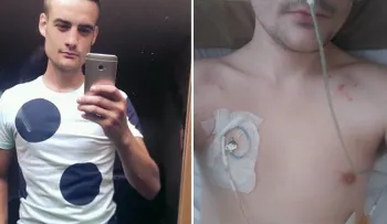 Un joven con rara enfermedad no puede ir al baño 