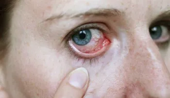 10 síntomas de cáncer que muchos ignoran