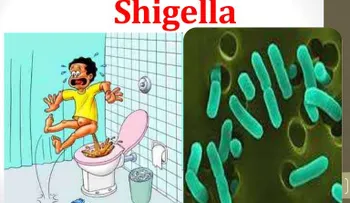 Importante: Síntomas de la bacteria Shigella
