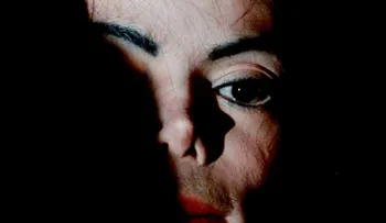 Michael Jackson y los escalofriantes detalles de la autopsia. Calvo y con cicatrices en todo el cuerpo. 