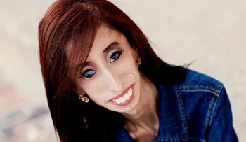 El inspirador video de "la mujer más fea del mundo"