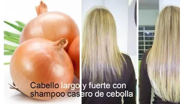 Cómo haber champú de cebolla, para que el pelo crezca de forma rápida y saludable