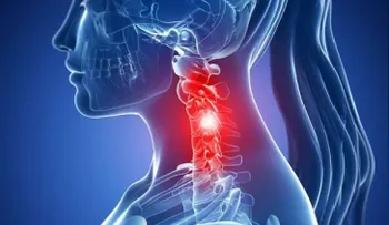 6 ejercicios para eliminar el dolor cervical