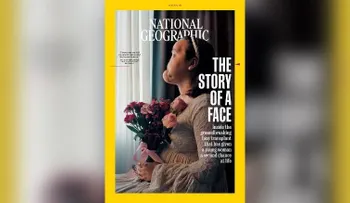 Le hacen un histórico trasplante de rostro a una adolescente que intentó suicidarse 