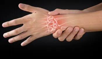 La artritis reumatoide es una enfermedad que "te enseña a vivir con el dolor"