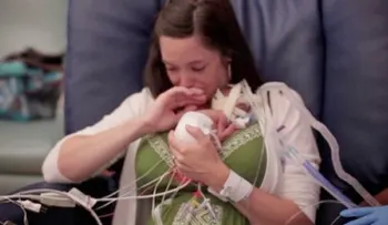 Video: ¡Extraño! Bebé con envejecimiento prematuro