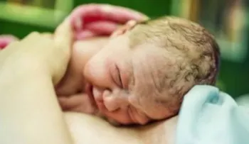 5 cosas que debes saber sobre el parto por cesárea