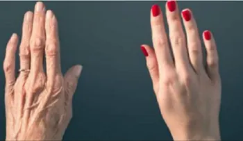 Tus manos revelan tu edad! Descubre cómo parar eso!