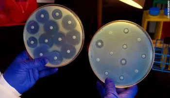 ¿Por qué mandan al espacio una superbacteria resistente a los antibióticos?