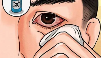 Conjuntivitis: causas y síntomas. ¿Cómo tratarla correctamente?