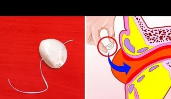 El ajo tiene propiedades médicas INCREIBLES: Cómelo todos los días y mira lo que sucede