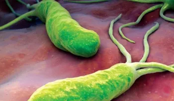 Cómo luchar contra la bacteria que causa ardor, diarrea e hinchazón