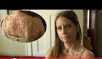 Los hombres sienten miedo de acercarse a ella. Pero a los 16 años nunca hubiera imaginado esta pesadilla