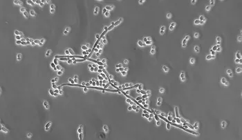 Las candidiasis son infecciones agudas o crónicas de la piel; cómo prevenirla