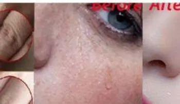  Colócate esta mascarilla en la noche y despierta como un príncipe o una princesa 