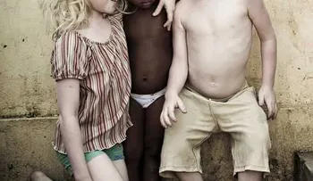 3 hijos albinos tiene una madre de color (Video)