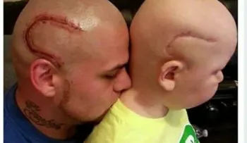 Padre se tatúa la cicatriz de su hijo para apoyarlo en su lucha contra el cáncer