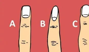 Dime cómo la forma de tus falanges y te diré algo impresionante sobre tu salud y personalidad