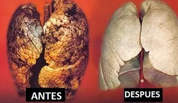 En 72 horas: Cómo purificar tus pulmones 