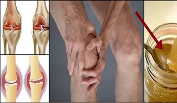 La raiz del dolor de rodilla es un daño del cartilago, por lo que esta es la forma de regenerarlo naturalmente