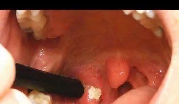 Esta es la verdadera razón por la que tienes mal aliento y como eliminarlo! (VIDEO)