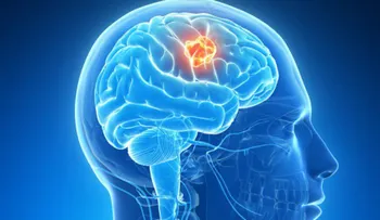  Nuevo descubrimiento terapéutico contra el glioblastoma, de los tumores más letales 