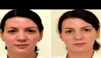 Comprobación científica: tres litros diario de agua y mira como quedó mi rostro (VIDEO)