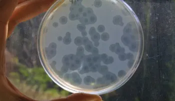 La OMS urge a hallar nuevos antibióticos para 12 superbacterias