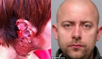 Le arranca un pedazo de oreja a su esposa