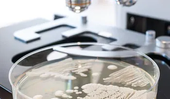 Prueba casera para detectar la cándida en el cuerpo y cómo eliminarla naturalmente