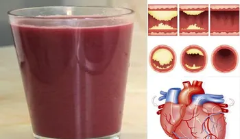 Este jugo limpias tus arterias y protege contra las enfermedades del corazón!