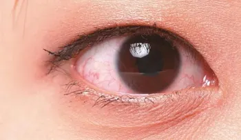 Científicos resucitarán ojos de fallecidos para experimentar con ellos