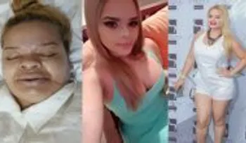 Una joven pierde la vida en una intervención quirúrgica y lo que dice el tío es ESCALOFRIANTE