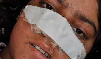 Hombre le corta la nariz a su esposa 
