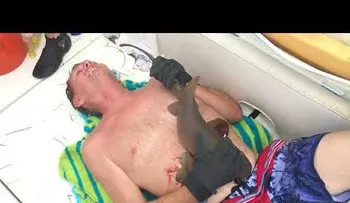 IMPACTANTE: Un tiburón muerde a un hombre en el vientre y no lo suelta