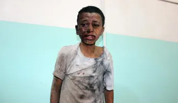 Los niños que murieron en Yemen estaban hablando y riéndose felices por su salida de campo apenas horas antes del ataque aéreo