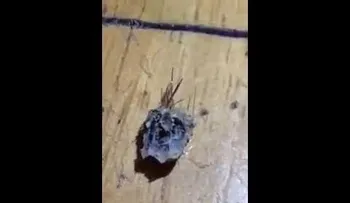 ADVERTENCIA IMAGEN FUERTE: ¡le sacan maraña enorme de pelusa del ombligo!