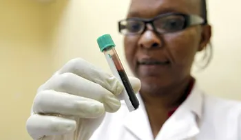 ¿Hallan en la sangre humana una llave para vencer al VIH?