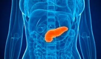 Cáncer de páncreas: Factores de riesgo, síntomas y prevención